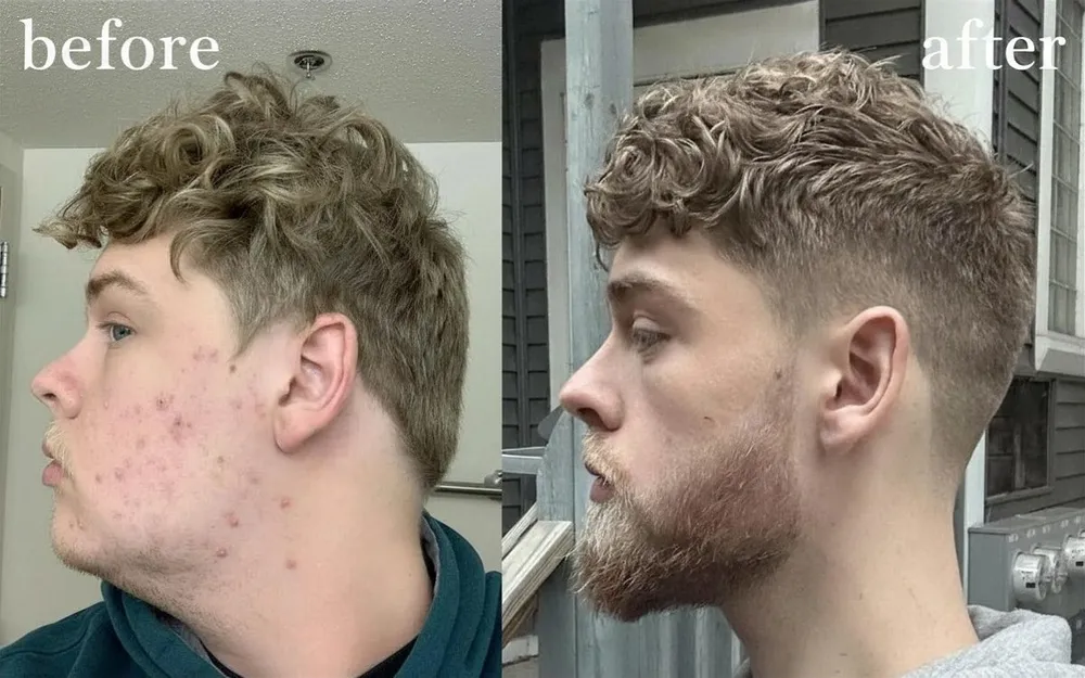 Looks Max user before and after
