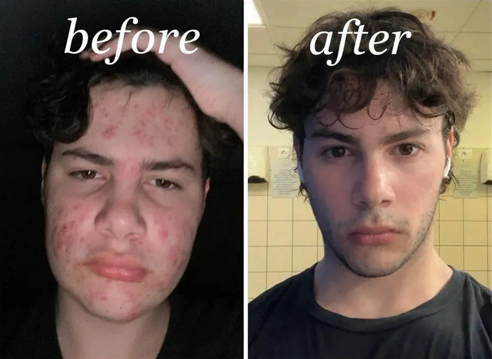 Looks Max user before and after